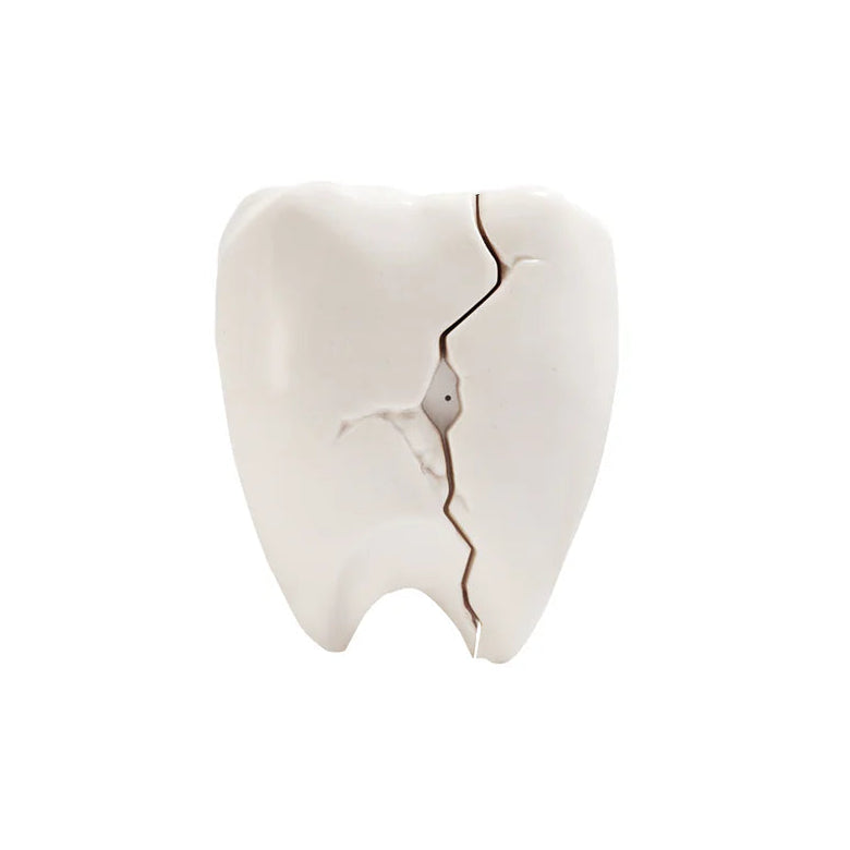 Cracked Teeth 3D AirPods Case