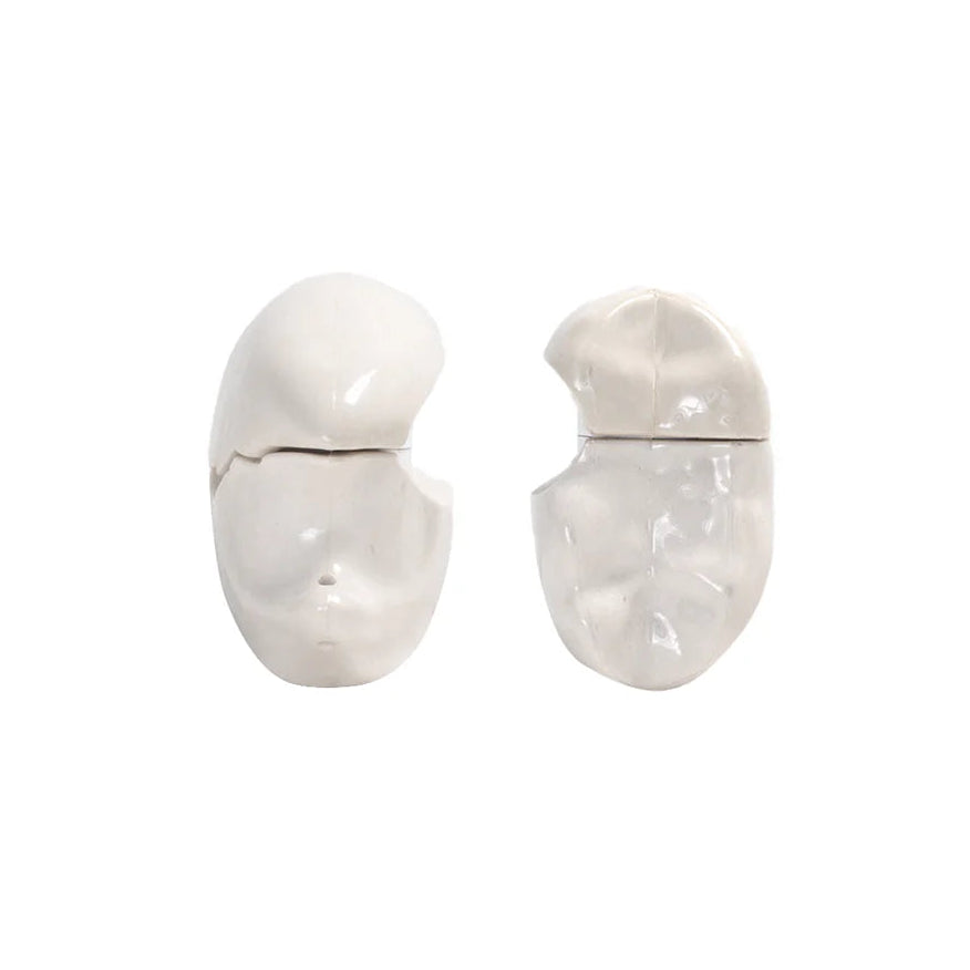 Cracked Teeth 3D AirPods Case