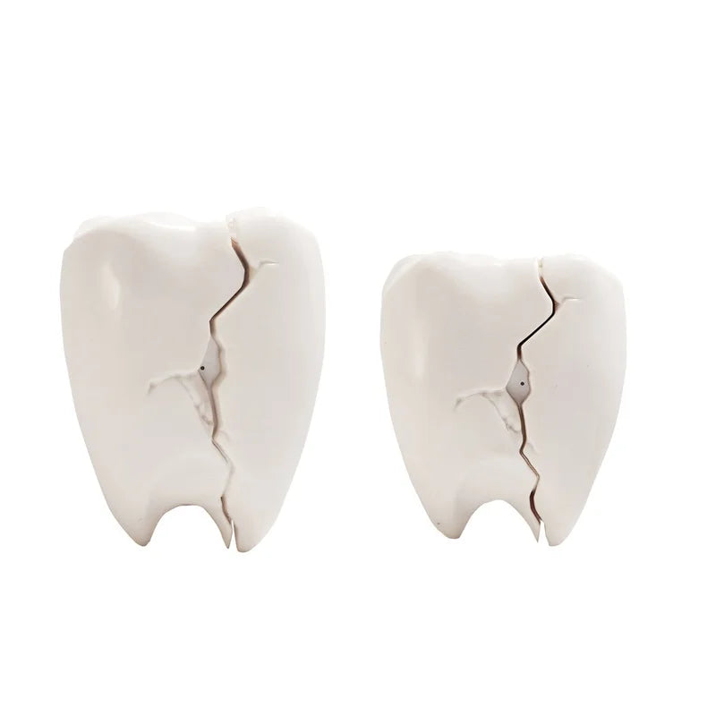 Cracked Teeth 3D AirPods Case